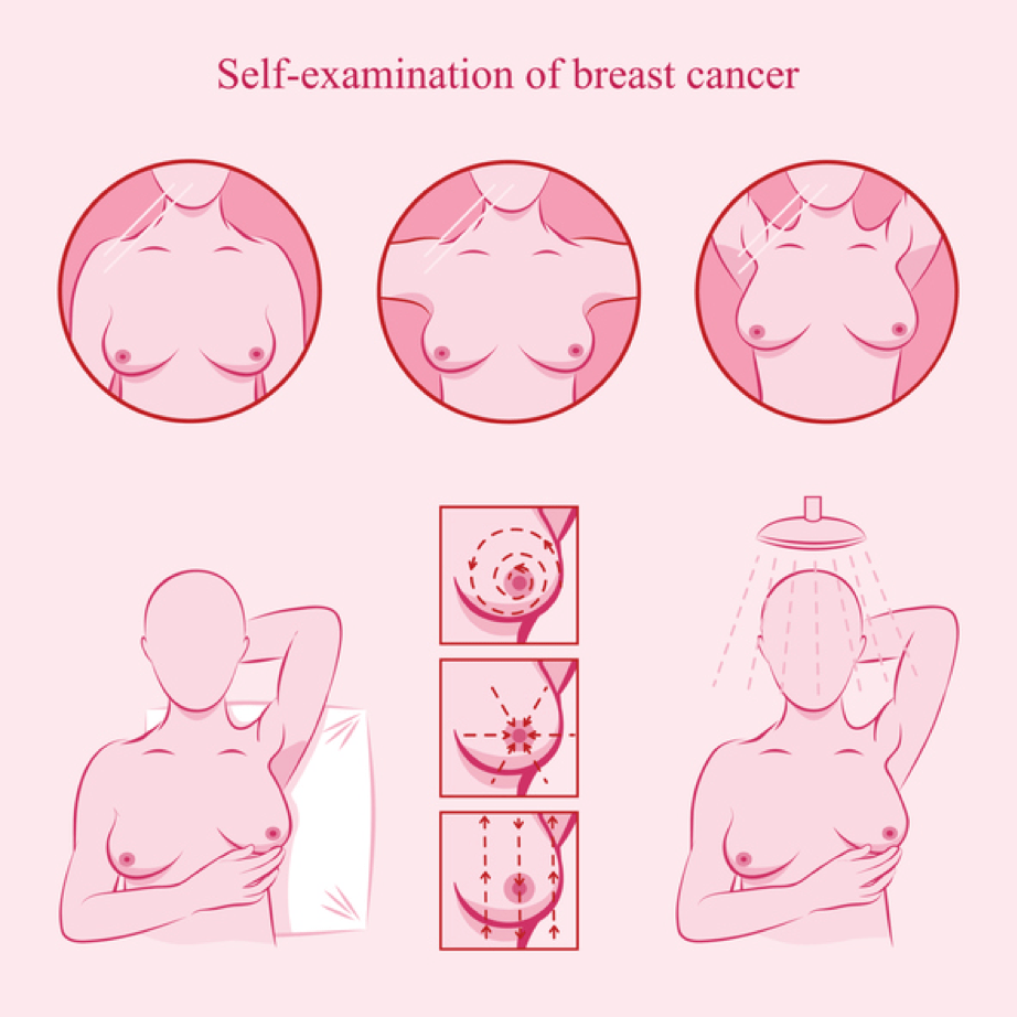 Breast self examination steps